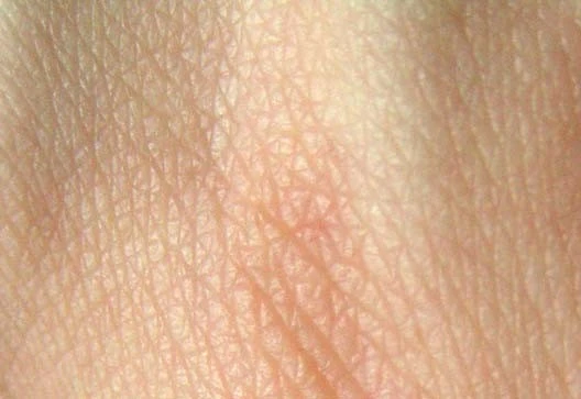 پوست 